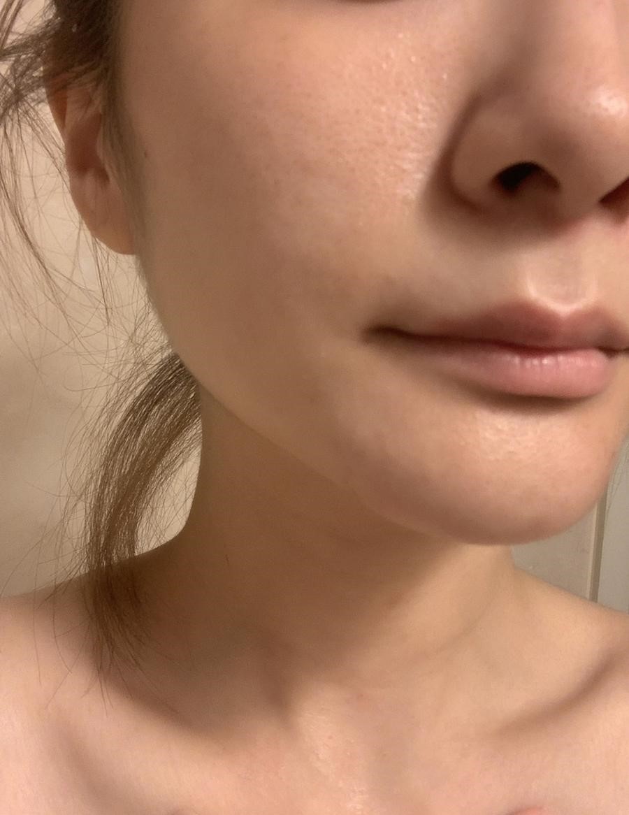 ミラブルで美肌を手に入れよう 効果とビフォーアフターをご紹介 どこでもミラバス正規販売店 ミラブルシャワーヘッドオンラインショップ